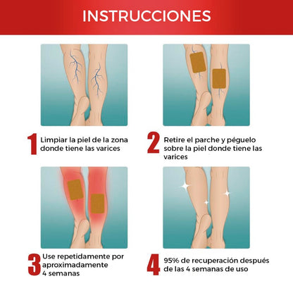 NUEVO SET DE PARCHES PARA VENAS VARICES